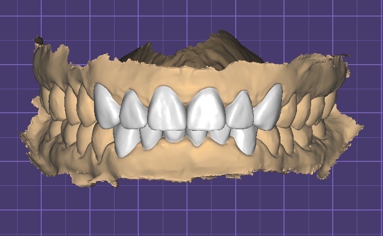 Smile makeover planning at FLOSS Dental Studio